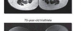 Athlete vs Couch Potato MRI